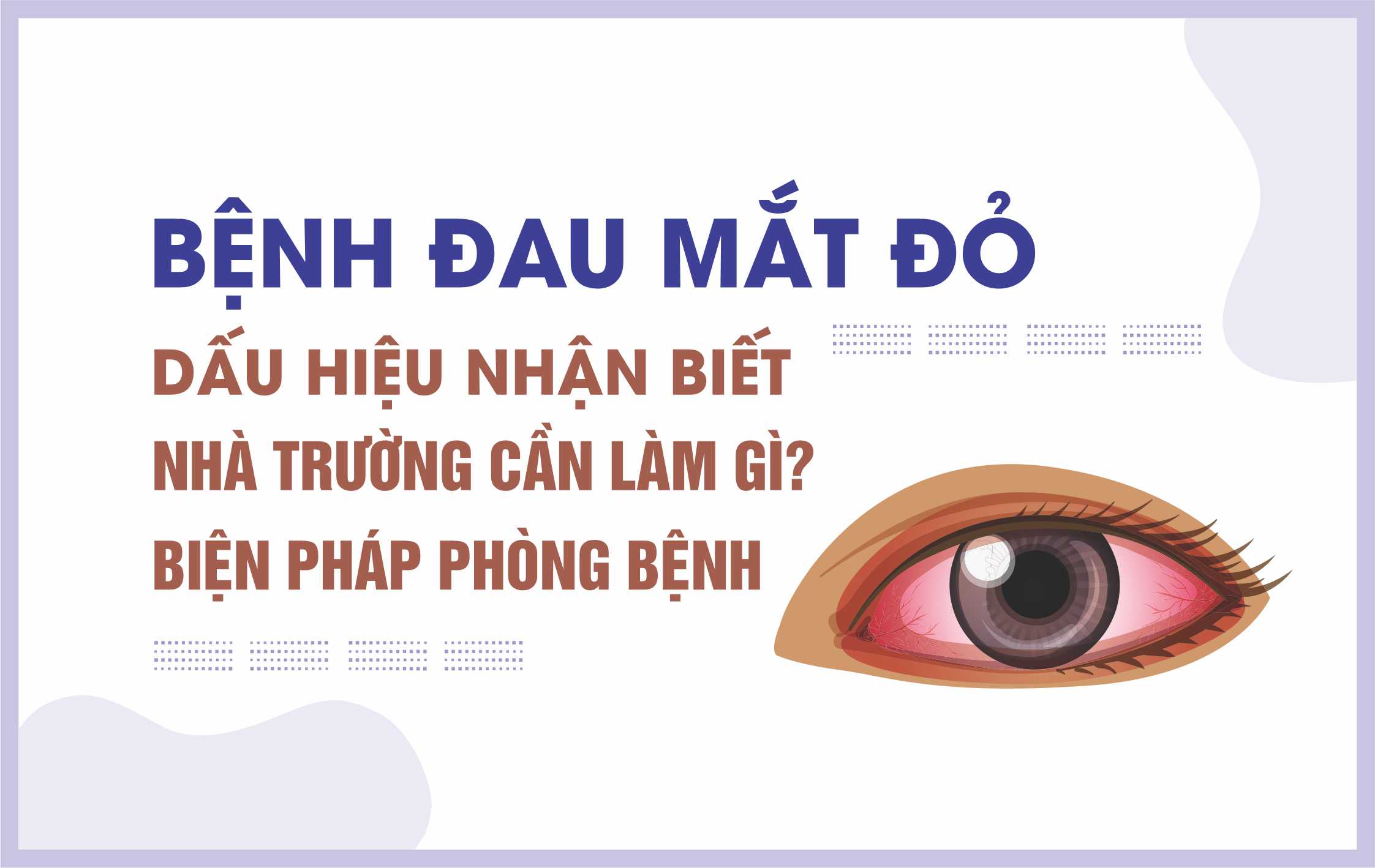 ĐAU MẮT ĐỎ Ở TRẺ EM: DẤU HIỆU VÀ CÁCH PHÒNG BỆNH